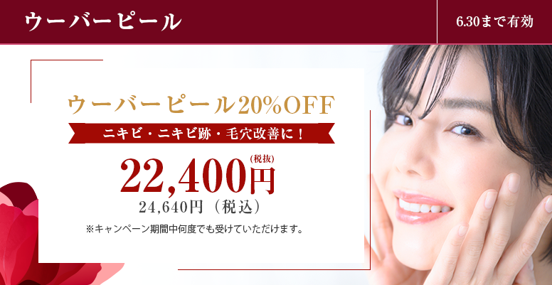 ウーバーピール20%OFF