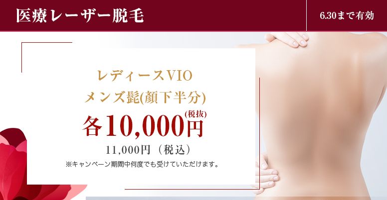 医療レーザー脱毛