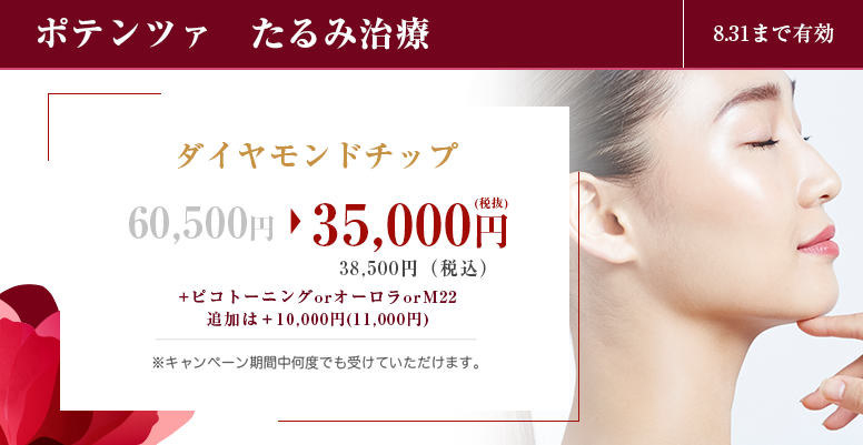 ポテンツァたるみ治療
