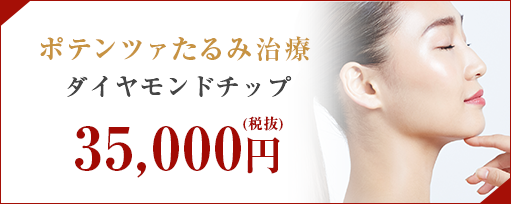 ポテンツァたるみ治療のサブスライド