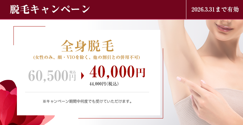 脱毛キャンペーン