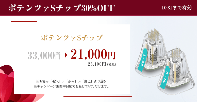 ポテンツァSチップ<br>30%OFF